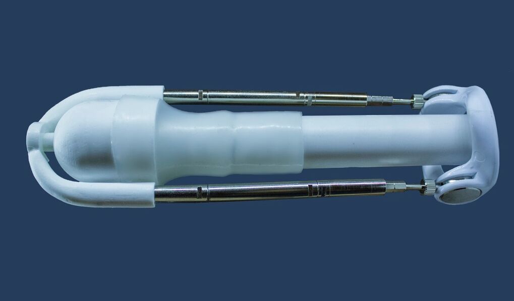 An extender is a device that lengthens a man's penis in length.