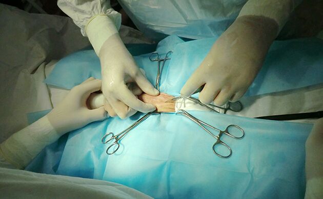 Reproductive organ surgery will help increase its size